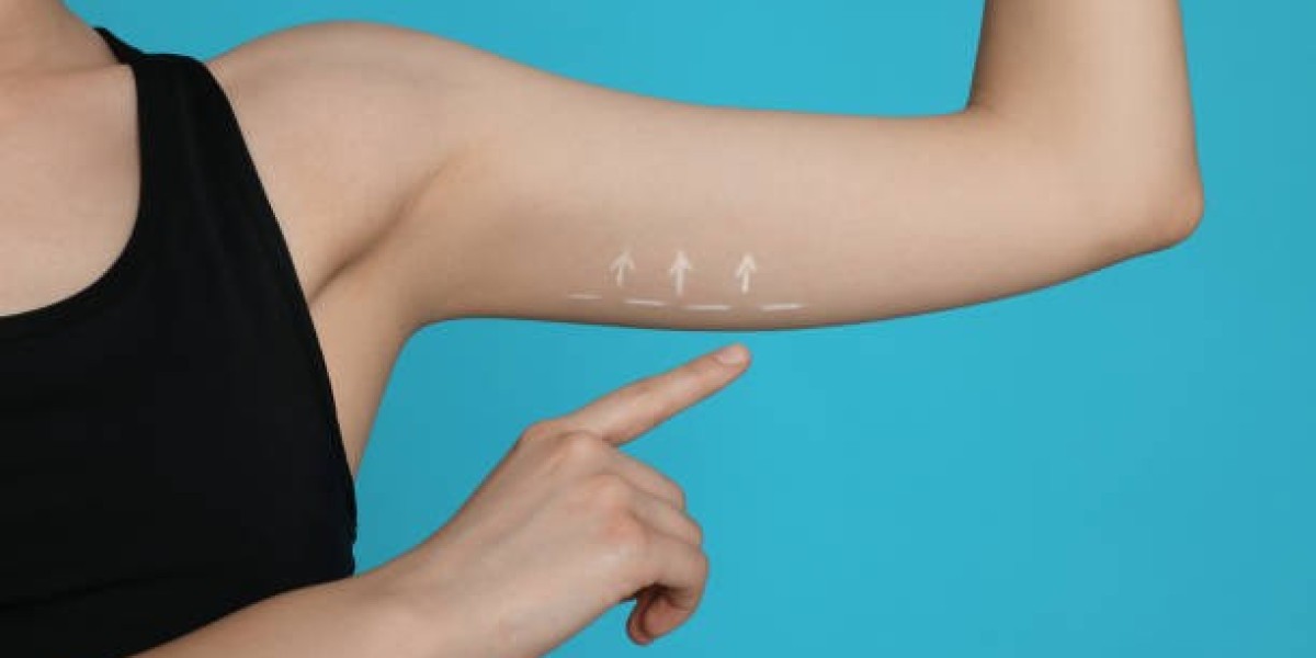 Arm Lift Surgery Recovery and Returning to Daily Activities