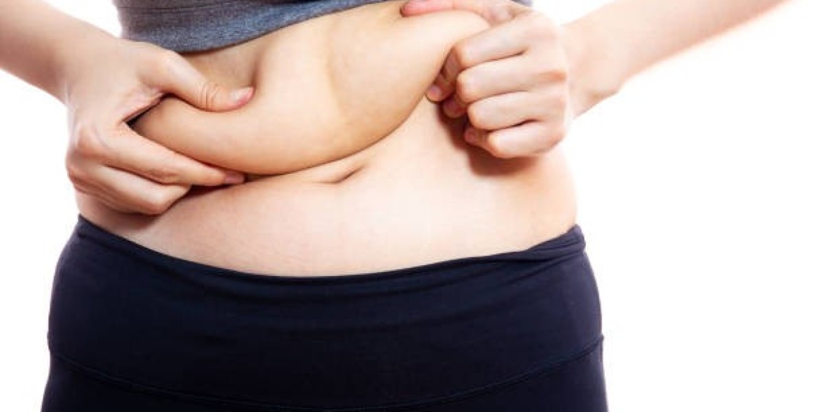 Liposuction vs. Weight-Loss Surgery: Key Differences
