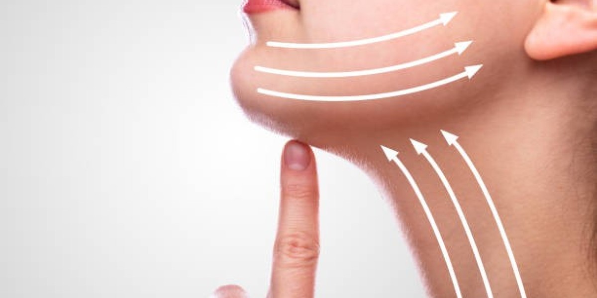 Facelift Surgery in Riyadh: Understanding Modern Facial Rejuvenation