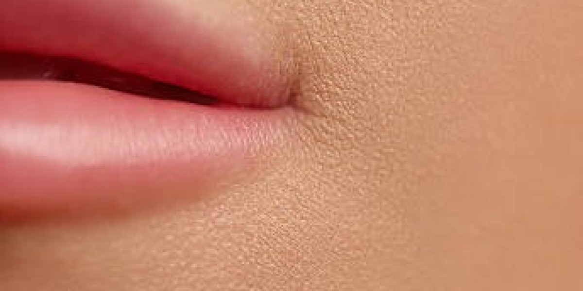 Medlite Q-Switch Laser for Lips: Riyadh Promotions
