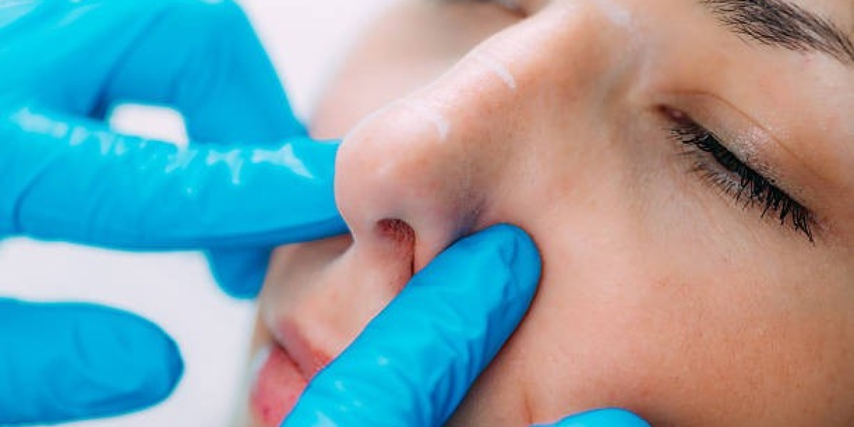 Rhinoplasty for Women: Planning Your Procedure