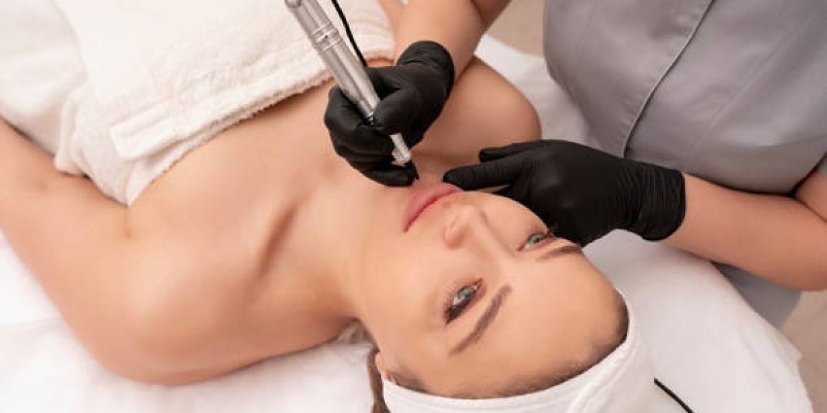 Dermapen for Smoother and Healthier-Looking Skin