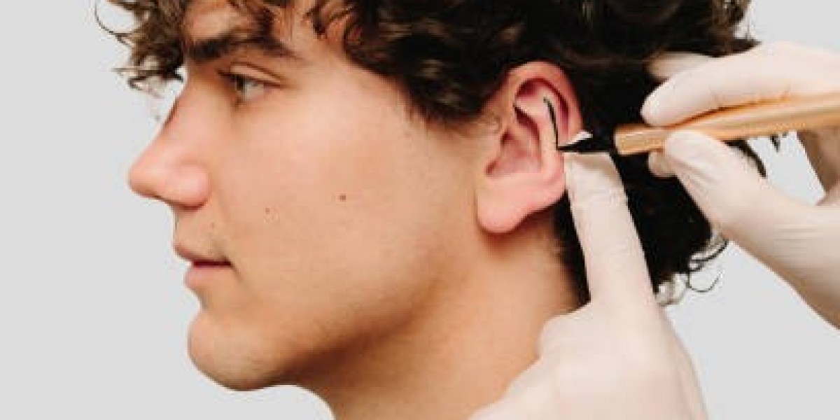 Ear Reshaping for Prominent Ears in Riyadh