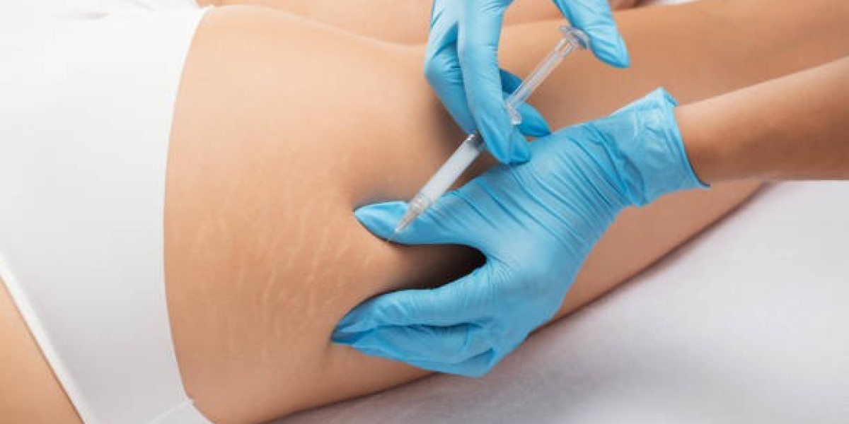 Sculptra vs Radiesse: What to Expect From Your Treatment Results