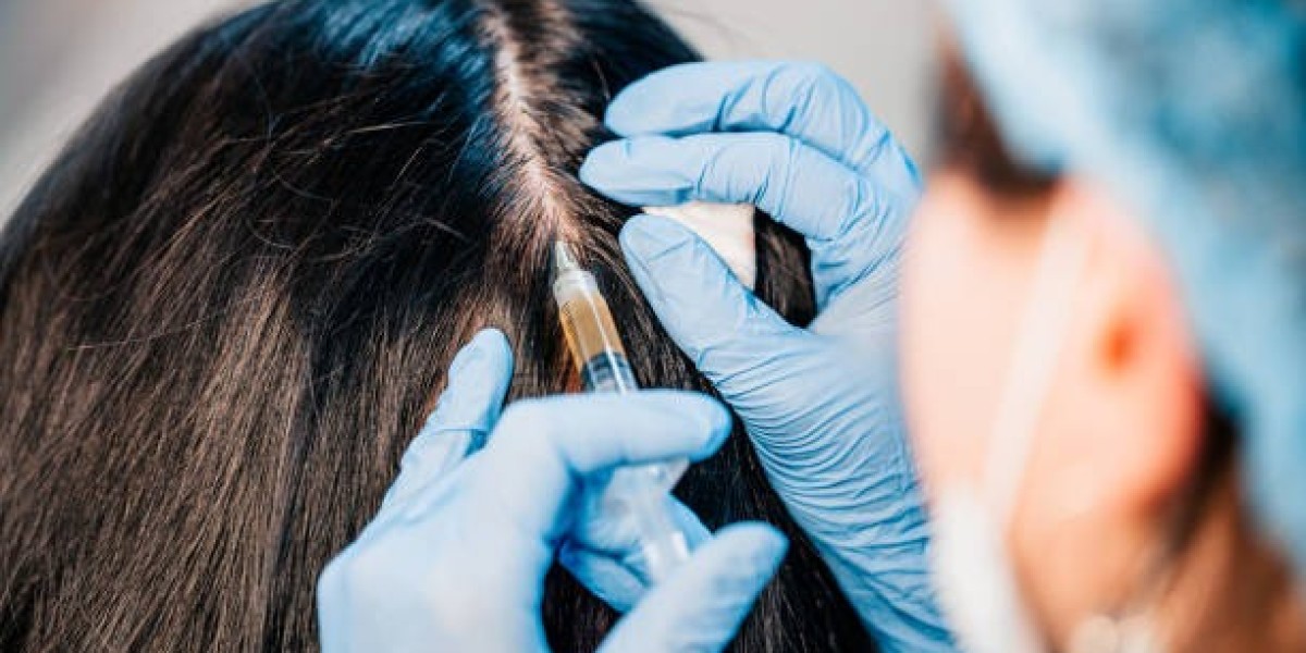 PRPHairTreatment Aftercare Guide: How to Care for Your Scalp Following Treatment