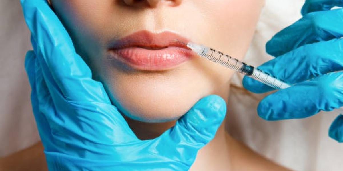 Lip Fillers Injections: Benefits, Results, and Expectations